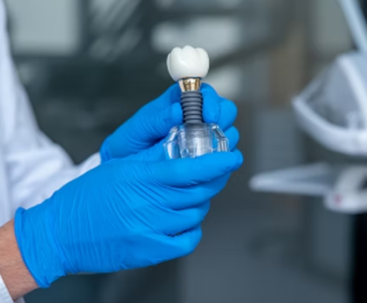 Імплантація зубів