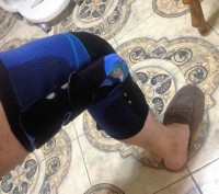 SofTec® Genu
Многофункциональный ортез для стабилизации коленного сустава.
Пат. . фото 3