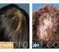 Silk Hair - Сыворотка для роста и восстановления волос (Силк Хэир)
Silk Hair спо. . фото 4