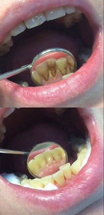 Найдите своего стоматолога уже сейчас,поддерживаю крепкое здоровье Ваших зубов!
. . фото 3