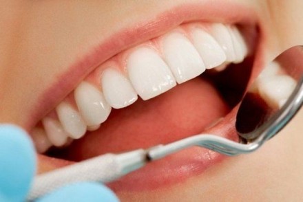 Отбеливатель для зубов быстро и качественно, буквально за неделю ( в зависимости. . фото 3